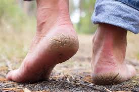 Perhaps this is a murder by drug cartels in. 17 Things That Can Go Wrong With Your Feet As You Age
