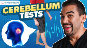 Image result for Cerebellar Function Test