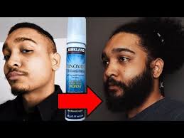 14 Men Who Grew A Beard With Minoxidil