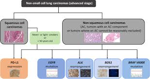 Lung cancer, also known as lung carcinoma, is a malignant lung tumor characterized by uncontrolled cell growth in tissues of the lung. Updated Guidelines For Predictive Biomarker Testing In Advanced Non Small Cell Lung Cancer A National Consensus Of The Spanish Society Of Pathology And The Spanish Society Of Medical Oncology Springerlink