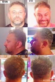 Check spelling or type a new query. 4 Guard Haircut Hairstyles Ideas For People Who Want More