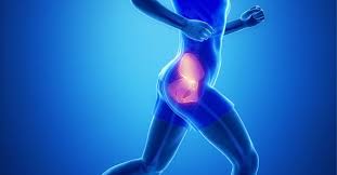 About hip and groin pain. Groin Pain Syndrome Archer Chiropractic