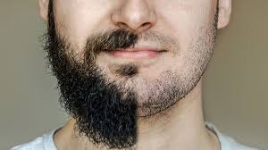 Electrolysis is an effective way of eliminating facial hair and is a technique that has been widely available for several decades now. People Are Now Concerned That You Re Not Hot Without Your Beard Dollar Shave Club Original Content