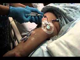 How To Draw Blood From A Picc. - Youtube