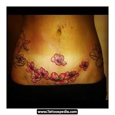 Are you considering having a #tummytucktattoo? Tummy Tuck Tattoos