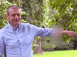 The major diagnostic criteria for sepsis are altered mental status, increased respiratory rate, and low blood pressure. Man Has Penis Grown On His Arm After Losing Genitalia To Sepsis The Independent The Independent