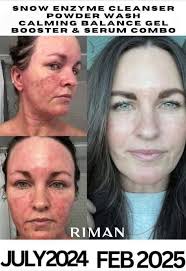 Is the Snow enzyme cleanser in your routine yet?