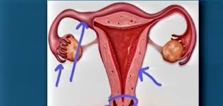 Ch T Le Vaginisme