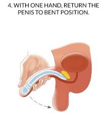 We did not find results for: Faq Zephyr Surgical Implants