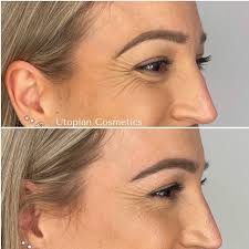 UTOPIAN COSMETICS by Dr Dennis (@utopiancosmetics) • Instagram photos and  videos