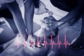 Artigo sobre a parada cardiorrespiratória, quais são os fatores que podem levar a parada do coração, como fazer a reanimação, tipos de paradas cardiorrespiratórias, etc. Parada Cardiorrespiratoria Mundo Educacao