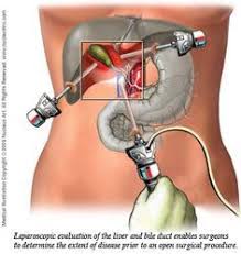 Pin Em Liver