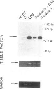 In addition, intracranial recordings of the stn area revealed increased. Effect Of P Selectin Stimulation On Tissue Factor Mrna Levels Reverse Download Scientific Diagram