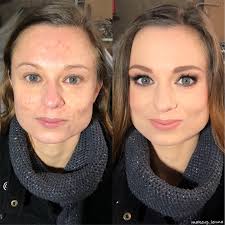 No photoshop needed... just primer, corrector, makeup, highlighter and  powder, a bit blush and fixing. That's it 😉 #transformations  #beforeandafter #nophotoshopneeded #chalengeoftheday #justmakeup  #makeupmiracles #makeupartist #makeupbyme ...