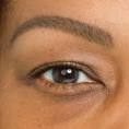Thinning eyebrows