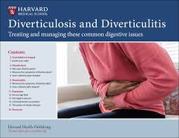Image result for Diverticulitis