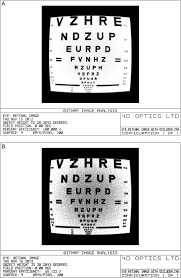 A Simulated Image Of A Logmar Visual Acuity Test Is Shown