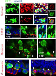 We did not find results for: Function Of Human Pluripotent Stem Cell Derived Photoreceptor Progenitors In Blind Mice Scientific Reports