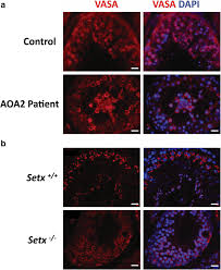 Detecting android open accessory 2.0 support. Disruption Of Spermatogenesis And Infertility In Ataxia With Oculomotor Apraxia Type 2 Aoa2 Springerlink