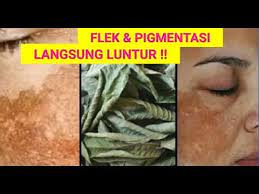 Cara menghilangkan flek hitam di wajah dengan daun jambu biji. Daun Jambu Batu Untuk Menghilangkan Flek Hitam Dan Pigmentasi Yang Bandel Youtube