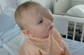 Fundraiser by Robert Heldreth : Help Baby Luke Recover from Retinoblastoma