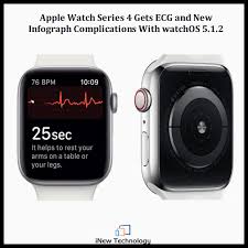 The Ecg App Is Exclusive To Apple Watch Series 4 Which Sports A New Electric Heart Rate Sensor The Apple Watch Series Would Ecg App Apple Watch Apple Update