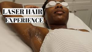 Home use devices like the ones in our reviews below are and the armpit attachment makes tackling that part of the body a breeze. Underarm Laser Hair Removal On Dark Skin Youtube