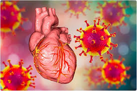 It can present as an acute, subacute, or chronic disease process and may present with either focal or diffuse involvement of the myocardium. Le Risque De Myocardite De L Infection Sars Cov 2 Est Plus Eleve Dans De Jeunes Males Decouvertes D Une Etude