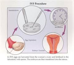 Please send love, prayers, good vibes/energy for. Ivf Vs Iui Which One Is Right For You Genesis Fertility New York
