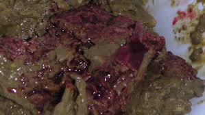 Image result for blood in stool human poop