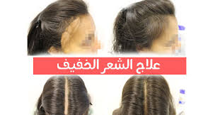 تقوية الشعر الخفيف جدا اجمل بنات