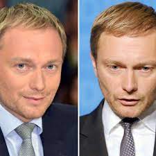 Haartransplantation vorher nachher bild klopp bart haartransplantation bart haare. Christian Lindner Lasst Sich Haare Transplantieren Panorama
