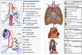 Lymph nodes are tender and hot. Bronchology A Well Branched Tree Intechopen