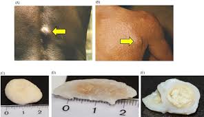 Image result for Oncinotis