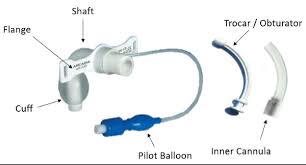 Image result for Tracheostomy