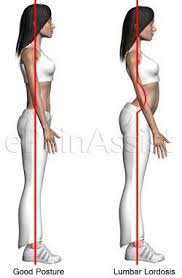 Lumbar Lordosis Or Lumbar Swayback 5 Simple Corrective Exercises Tips For Prevention Repinned Posturas Corporales Ejercicios De Postura Ejercicios De Yoga
