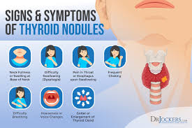 Luckily, most of them are benign. Thyroid Nodules Symptoms Causes And Support Strategies