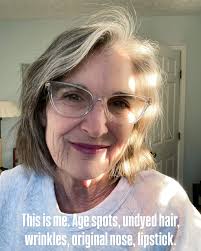 Several of you asked me to save this series of stories. Thanks for all the  kindness. I can get defensive and judgy about botox and nose jobs. The  pressure to be youthful