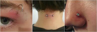 Piercing en la lengua infectado. Piercing Infectado Los Piercings Junto A Los Tatuajes By Victoria Lorenzo Medium