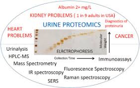 A urinalysis is a laboratory test to detect problems with your body that can show signs in your urine. Review Detection And Quantification Of Proteins In Human Urine Sciencedirect