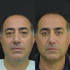 Advance Laser & Cosmetic Plastic Surgery