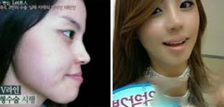 We did not find results for: Tag Plastic Surgery Soranews24 Japan News