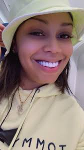 Smile design with composite veneers in Miami