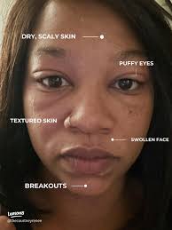 Don't F Up Your Skin! ‼️