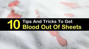 10 Incredible Ways To Get Blood Out Of Sheets