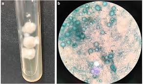 📦pacote de ritmos ou clube do ritmo: Disseminated Histoplasmosis In A Cat Rescued In Fortaleza Brazil And Successfully Treated With Itraconazole First Case Report Identified Molecularly Sciencedirect