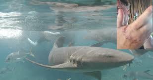 Shark attack is playable online as an html5 game, therefore no download is necessary. Video Nurse Sharks Bite Belize Vacationer S Hand