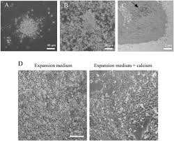 Retrouvez vos amis sur facebook. Functional Effects Of Proinflammatory Factors Present In Sjogren S Syndrome Salivary Microenvironment In An In Vitro Model Of Human Salivary Gland Scientific Reports X Mol