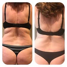Neora Firming Cream 30 Days‼️ | Age defying, Firming cream, Skin care