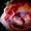 4 months pregnant and baby evolution. 1